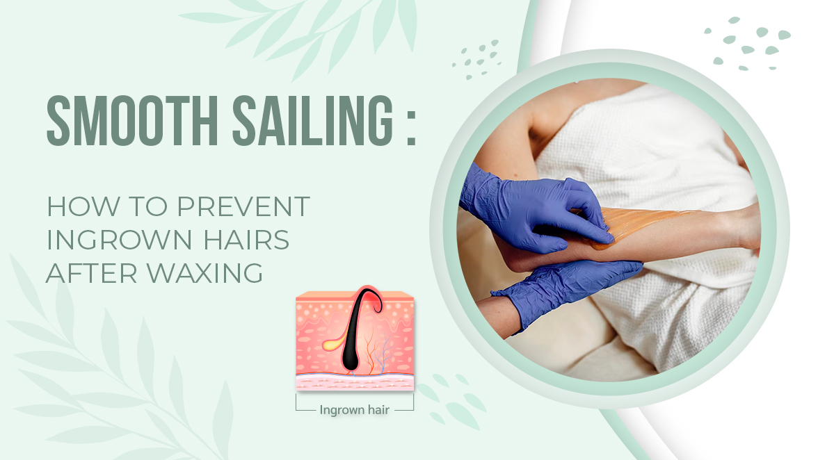 Smooth Sailing How To Prevent Ingrown Hairs After Waxing